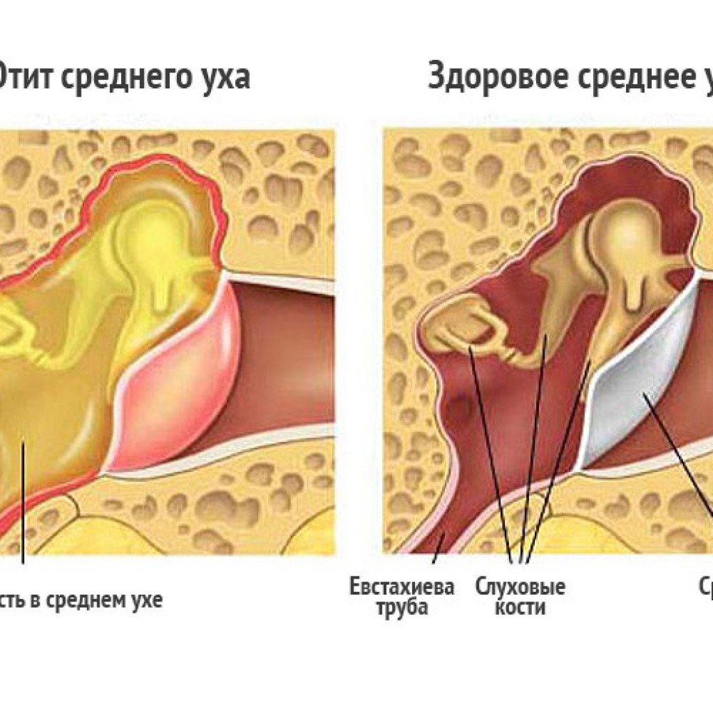 почему после оргазма уши закладывает уши фото 68